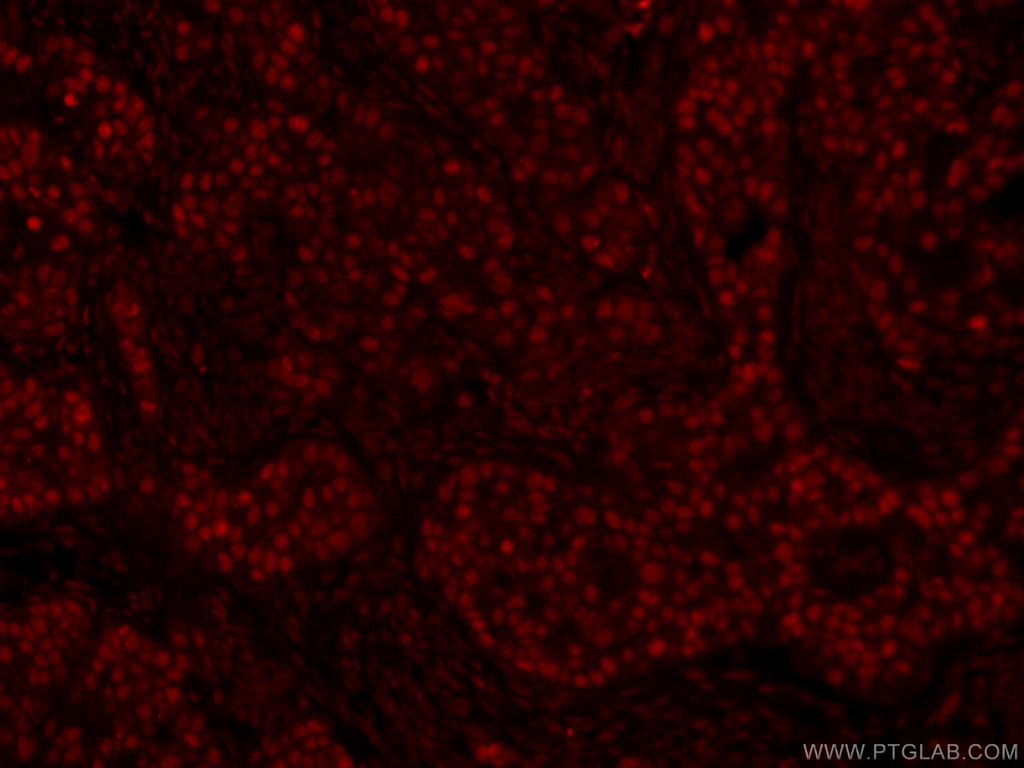 CoraLite®594-conjugated GATA3 Monoclonal antibody