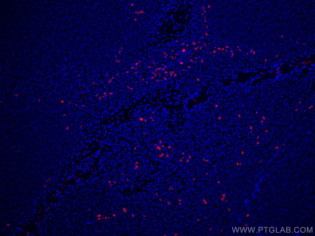 CoraLite®594-conjugated Human IgG4 Monoclonal antibody