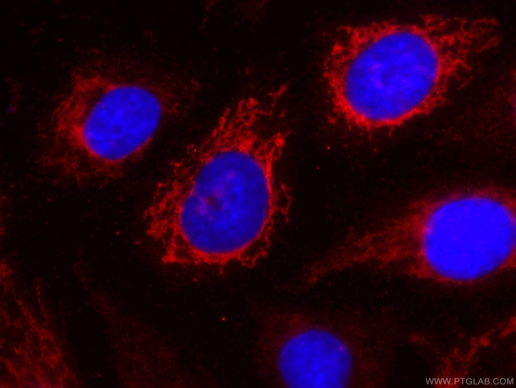 CoraLite®594-conjugated SOD2 Monoclonal antibody