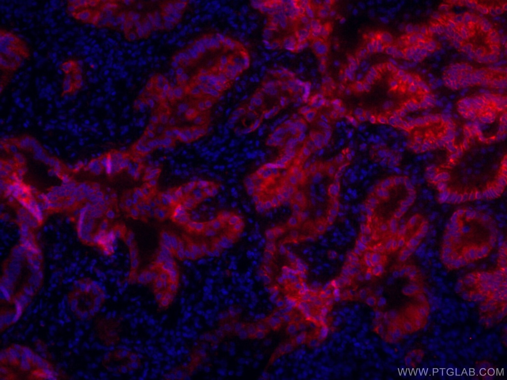 CoraLite®594-conjugated Cytokeratin 7 Monoclonal antibody