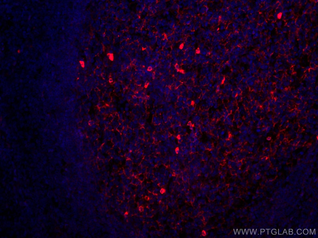 CoraLite®594-conjugated human IgM Monoclonal antibody