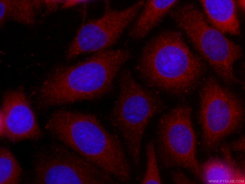 CoraLite®594-conjugated S100A4 Monoclonal antibody