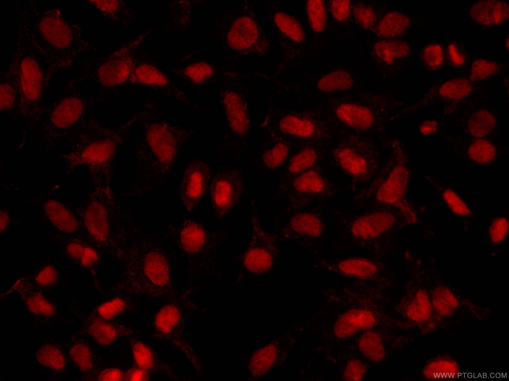 CoraLite®594-conjugated PARP1 Monoclonal antibody