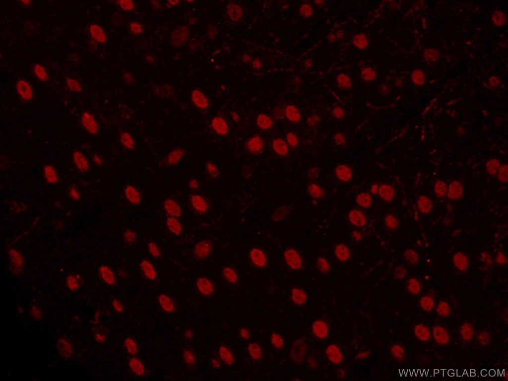 CoraLite®594-conjugated TBR1 Monoclonal antibody