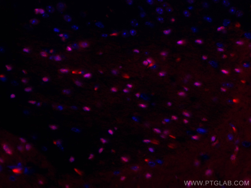 CoraLite®594-conjugated SOX10 Monoclonal antibody