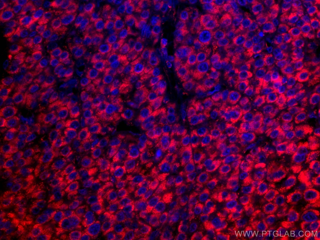 CoraLite®594-conjugated GLUD1 Monoclonal antibody