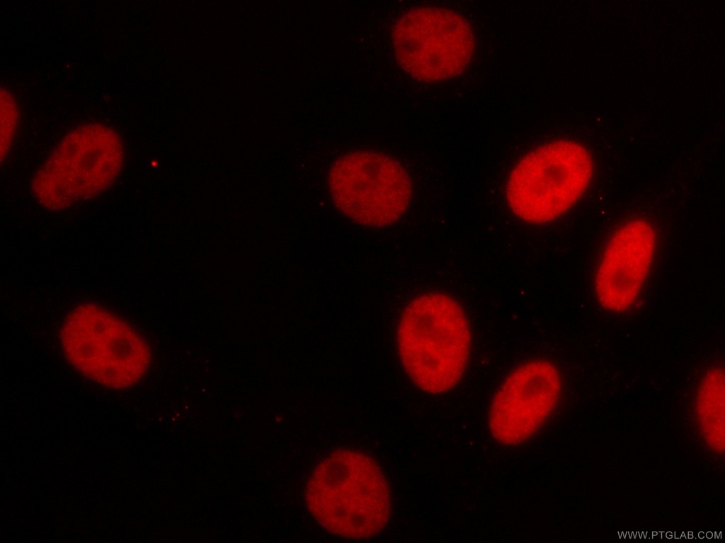 CoraLite®594-conjugated HDAC2 Monoclonal antibody