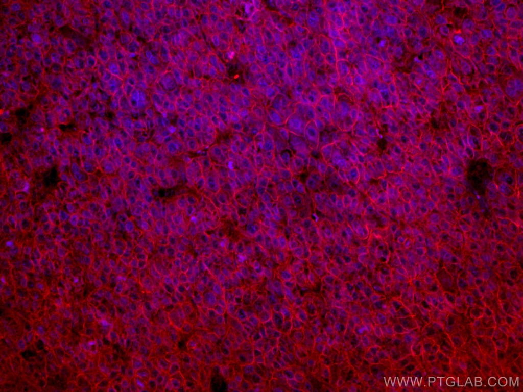 CoraLite®594-conjugated SLC31A1 Monoclonal antibody