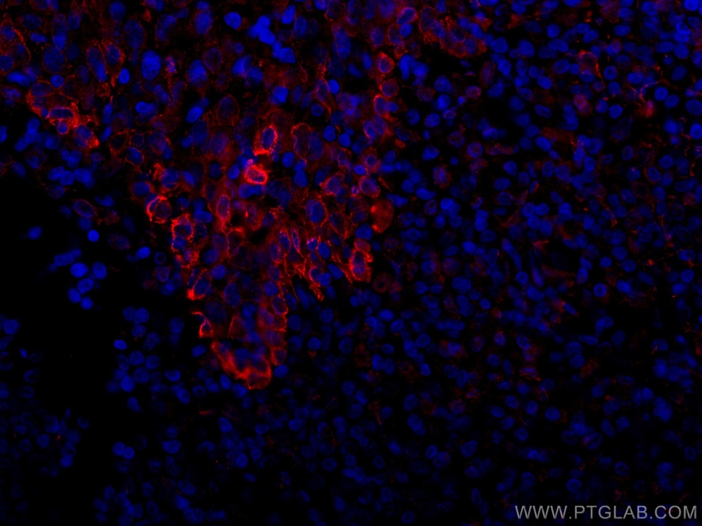 CoraLite®594-conjugated TLR8 Monoclonal antibody