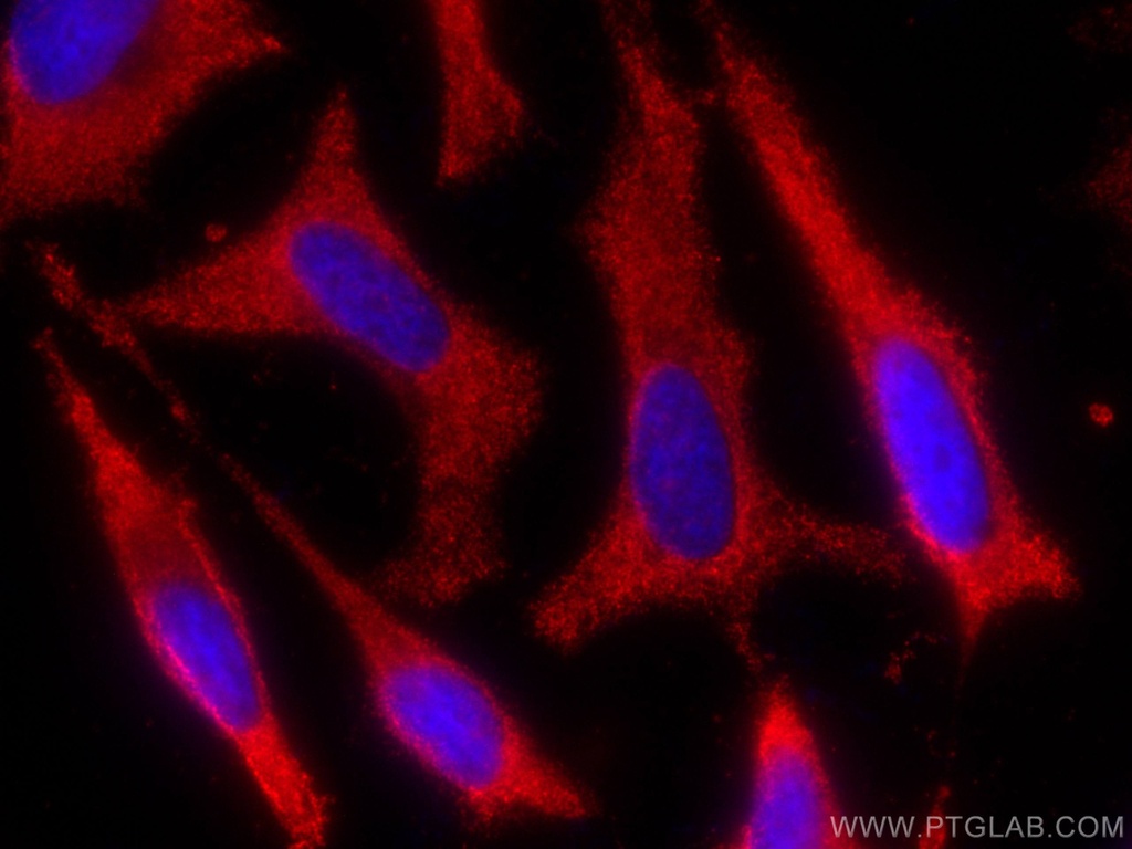 CoraLite®594-conjugated ALDH9A1 Monoclonal antibody