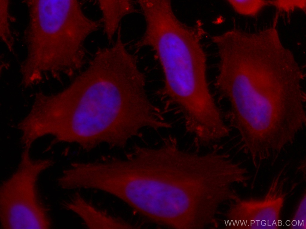 CoraLite®594-conjugated PFN1 Monoclonal antibody