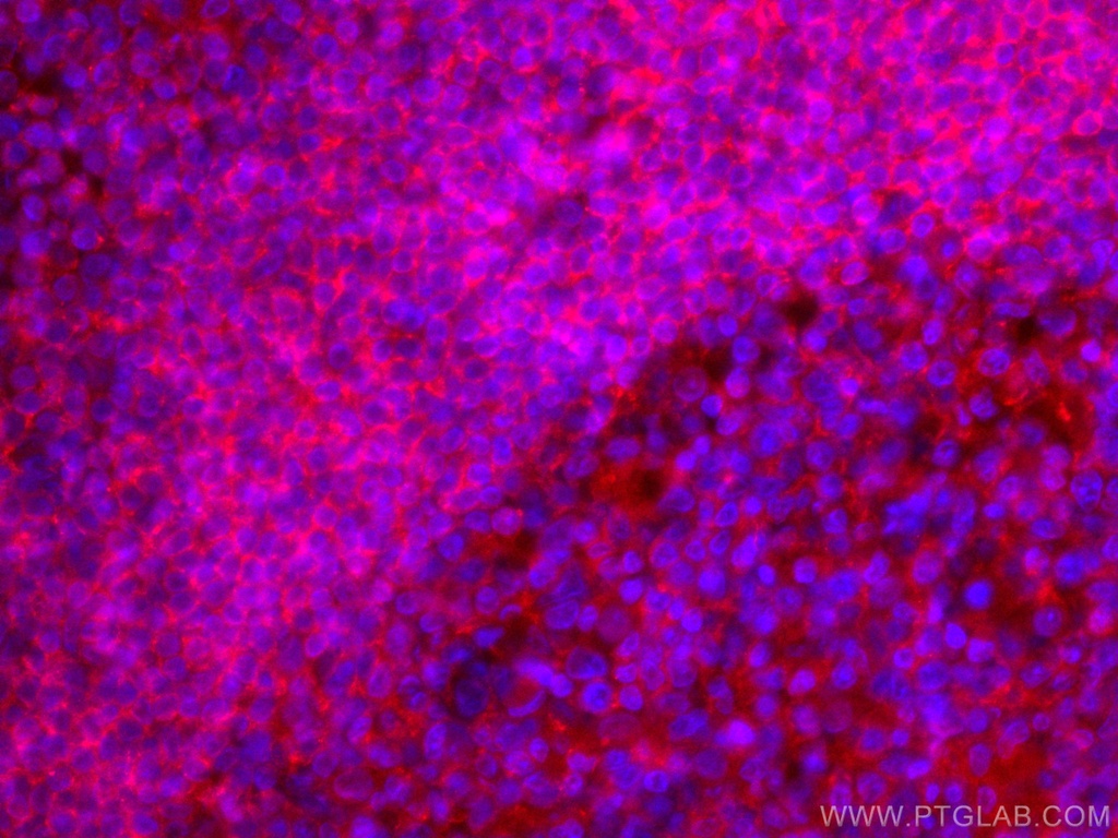 CoraLite®594-conjugated CD72 Monoclonal antibody
