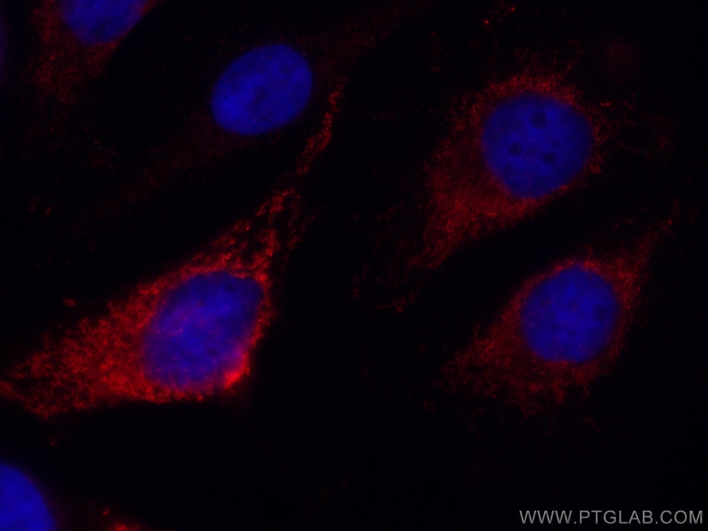 CoraLite®594-conjugated SNX5 Monoclonal antibody
