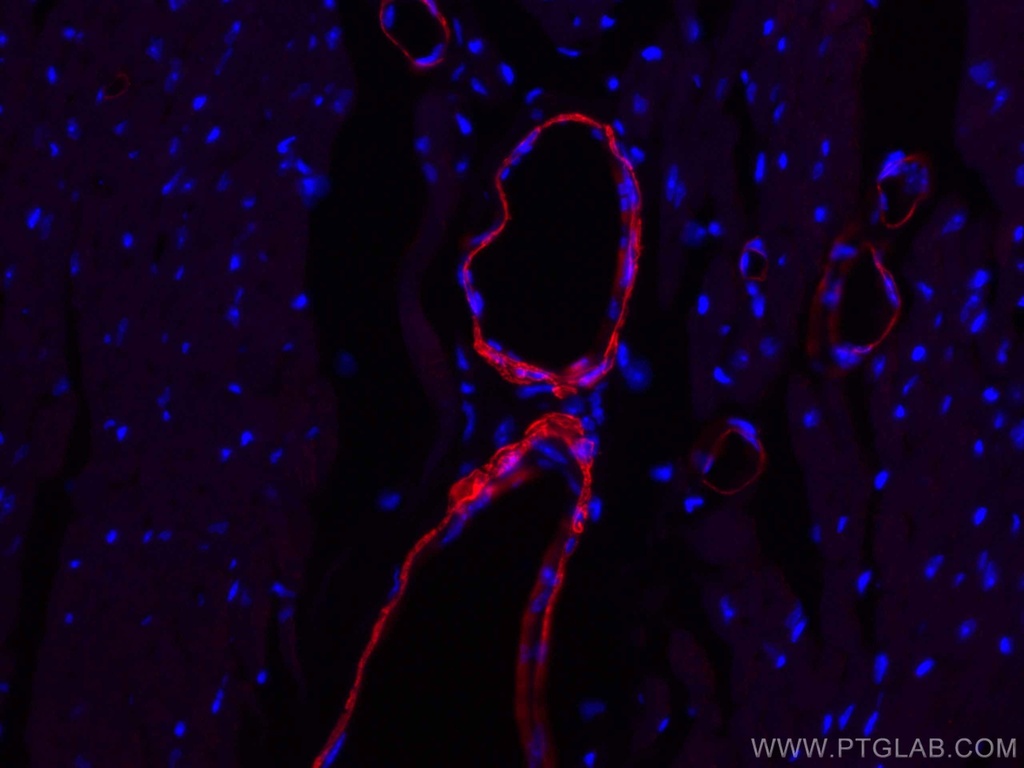 CoraLite®594-conjugated smooth muscle actin specific Monoclonal antibody