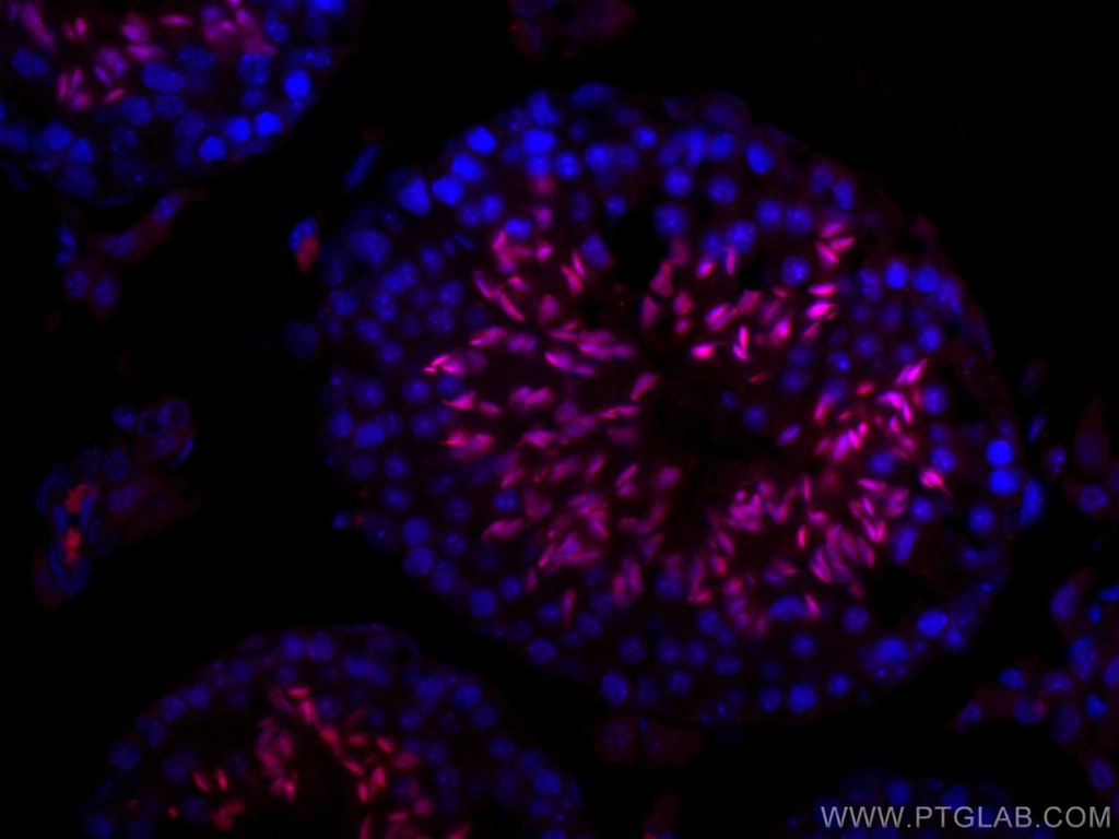 CoraLite®647-conjugated TNP1 Polyclonal antibody