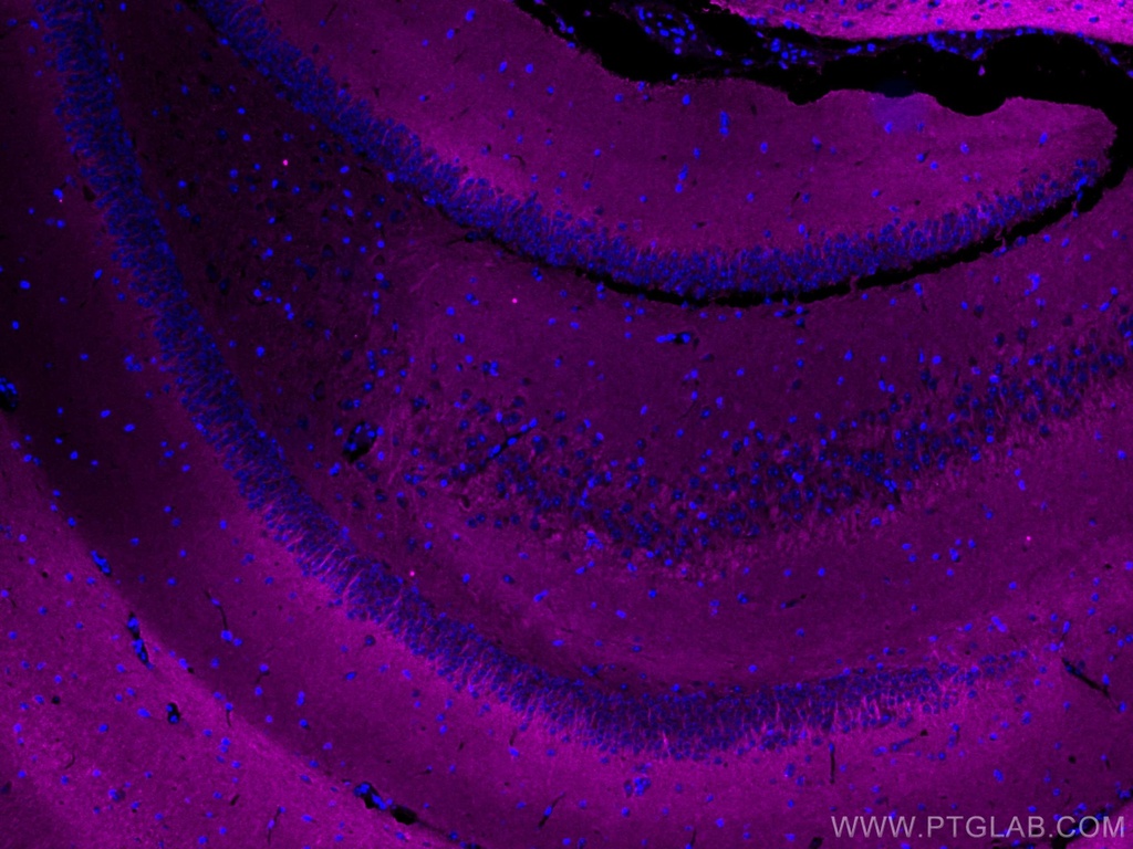 CoraLite®647-conjugated P2RY1 Monoclonal antibody