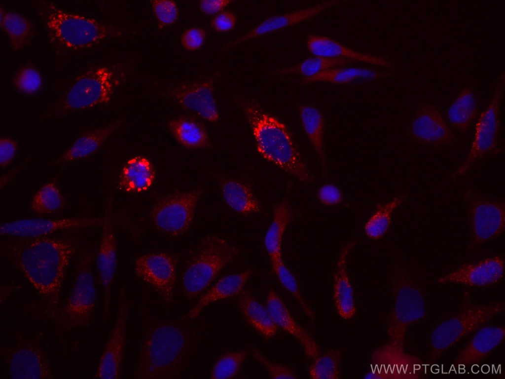 CoraLite®647-conjugated EPRS Monoclonal antibody