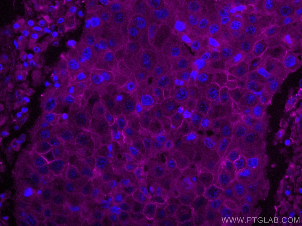 CoraLite®647-conjugated ALCAM Monoclonal antibody