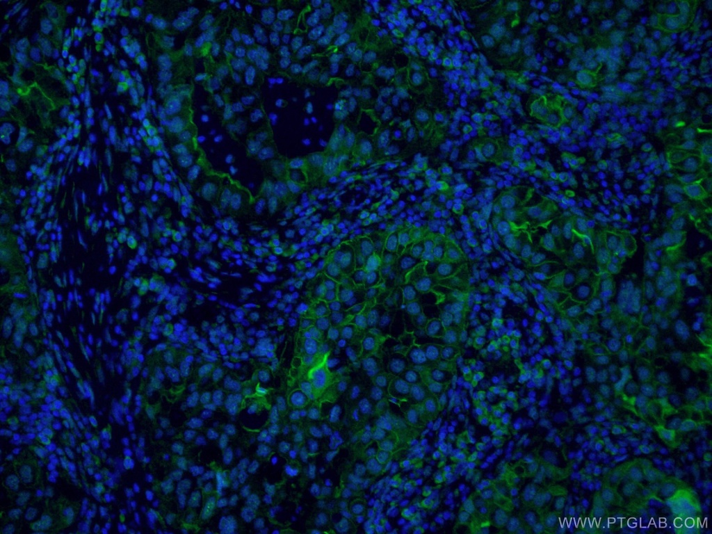 FITC-conjugated ICAM-1 Monoclonal antibody