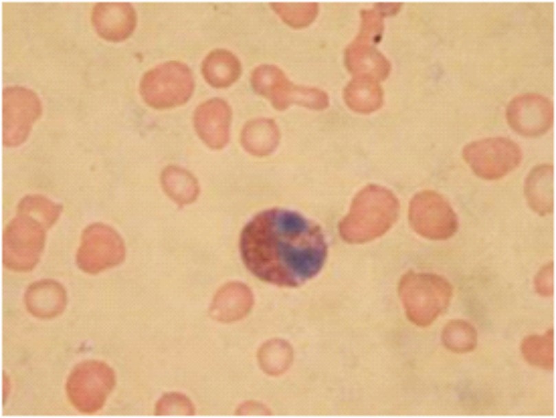 Giemsa stain