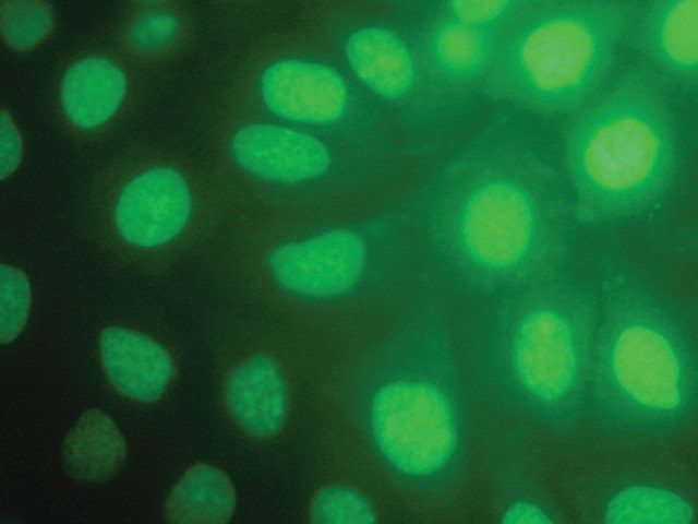 Acridine orange [TC262]