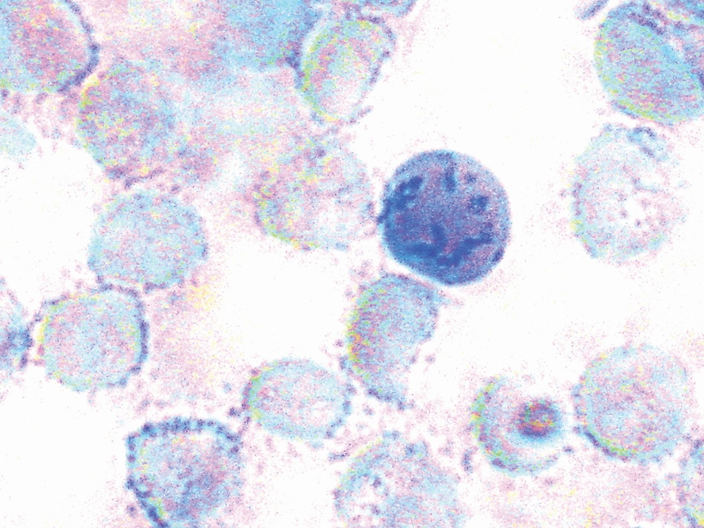 Reticulocyte Staining Solution     