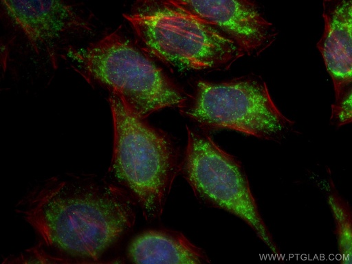 [10022-1-AP-150UL] cIAP1 Polyclonal antibody