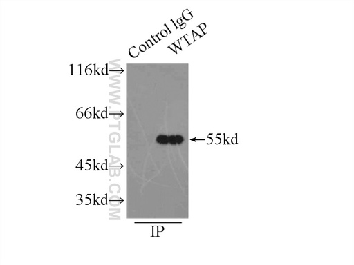 [10200-1-AP-20UL] WTAP Polyclonal antibody