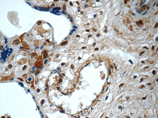 [10231-1-AP-20UL] SMAD4 Polyclonal antibody