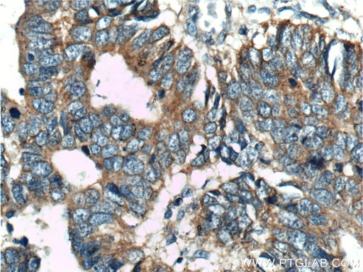 [10244-1-AP-20UL] USP11 Polyclonal antibody