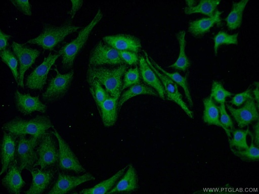 [10246-2-AP-20UL] CPLX1 Polyclonal antibody