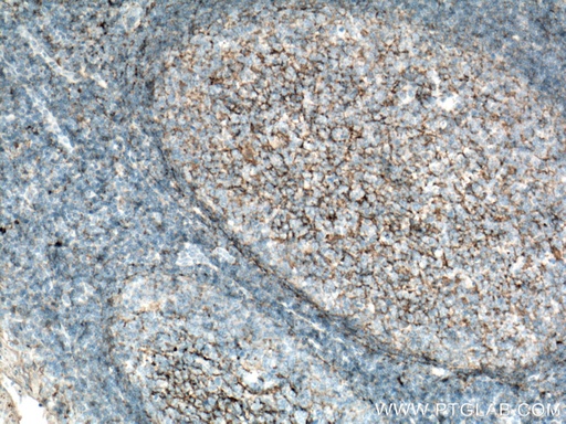 [10248-1-AP-20UL] CD82 Polyclonal antibody