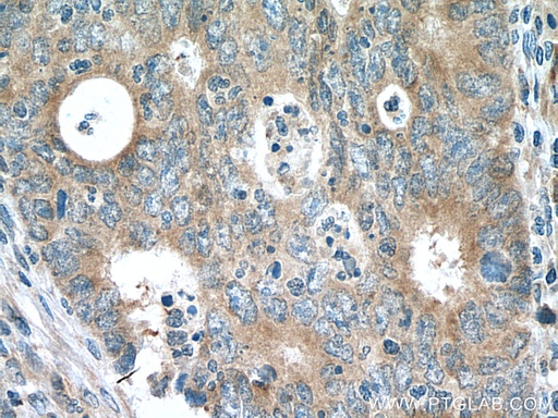 [10250-1-AP-20UL] NME6 Polyclonal antibody