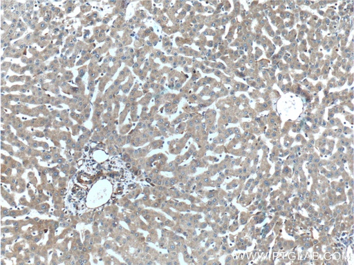 [10251-1-AP-20UL] TIP30 Polyclonal antibody