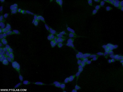 [10254-2-AP-150UL] GRB2 Polyclonal antibody