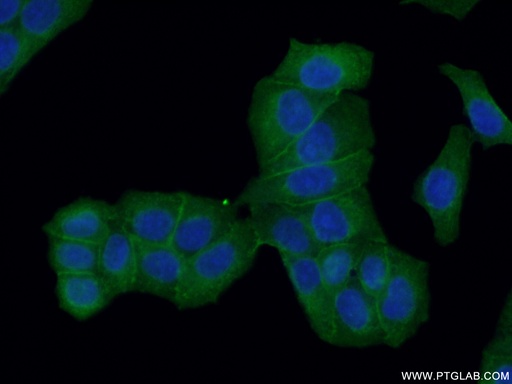 [10260-1-AP-150UL] Drebrin Polyclonal antibody