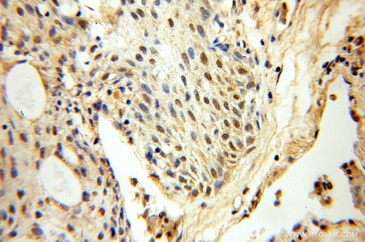 [10271-1-AP-20UL] FAF1 Polyclonal antibody