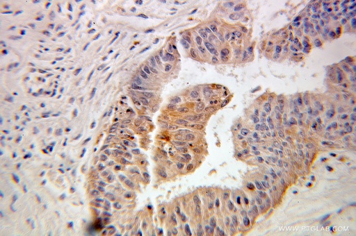 [10273-1-AP-20UL] FKBP1A Polyclonal antibody
