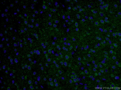 [10274-1-AP-150UL] TAU Polyclonal antibody