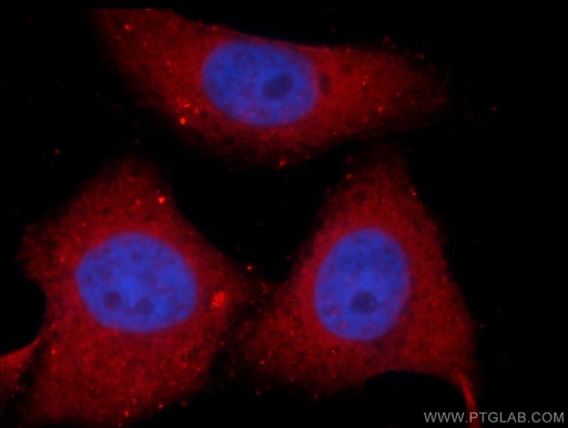 [10275-1-AP-150UL] SNX17 Polyclonal antibody