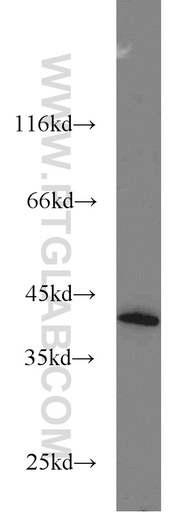 [10276-1-AP-150UL] DAP3 Polyclonal antibody