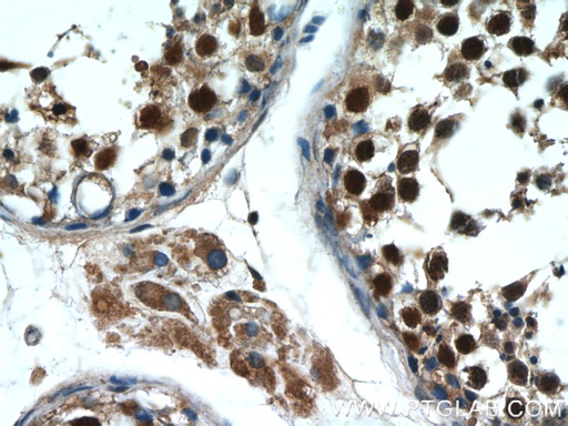 [10280-1-AP-150UL] MAGEC2 Polyclonal antibody