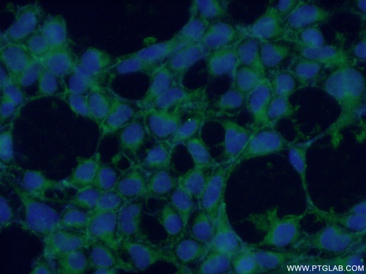 [10287-2-AP-20UL] CYPC Polyclonal antibody