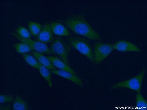 [10290-1-AP-20UL] AMPK Gamma 1 Polyclonal antibody