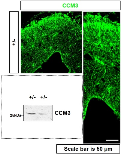[10294-2-AP-150UL] CCM3/PDCD10 Polyclonal antibody