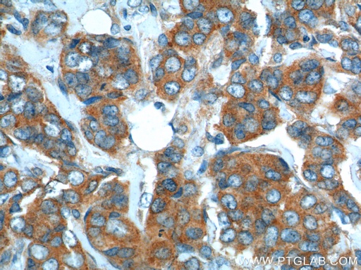 [10304-1-AP-150UL] SNX1 Polyclonal antibody