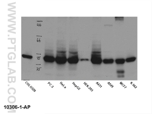 [10306-1-AP-20UL] B23/NPM1 Polyclonal antibody