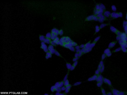 [10308-1-AP-20UL] AMPK Beta 1 Polyclonal antibody