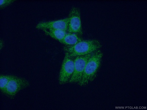 [10310-1-AP-20UL] MPV17 Polyclonal antibody