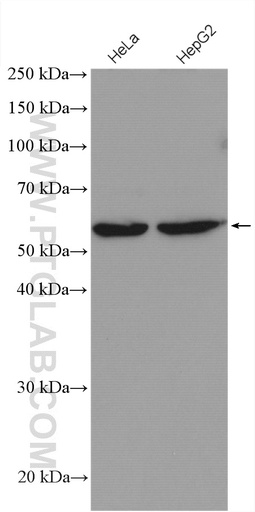 [10311-1-AP-20UL] RRP9 Polyclonal antibody
